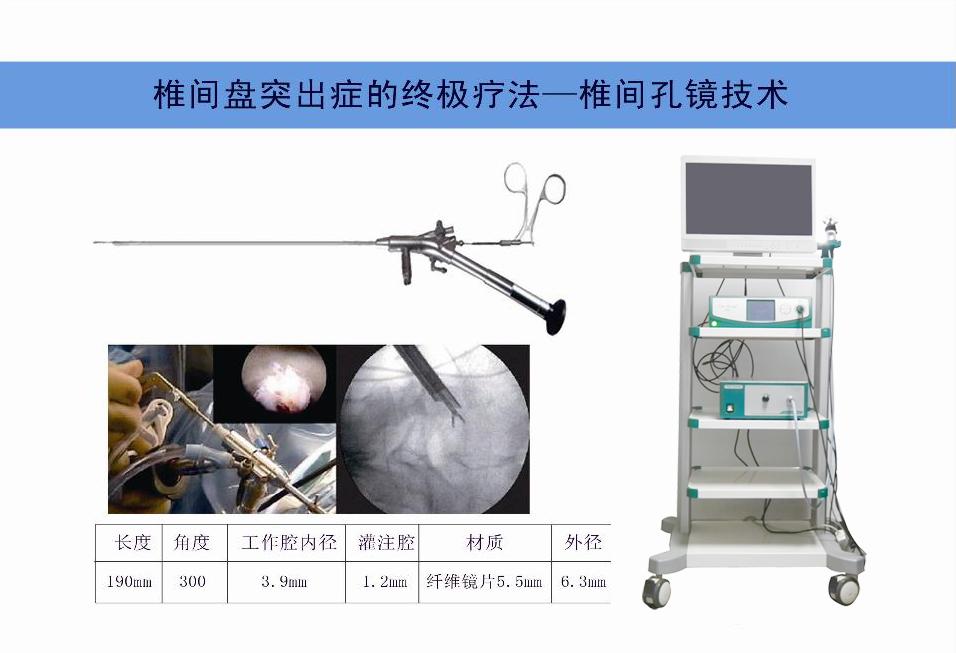 椎间孔镜手术系统具体详尽&nbsp;&nbsp;椎间孔镜技术