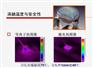 解释等离子手术系统