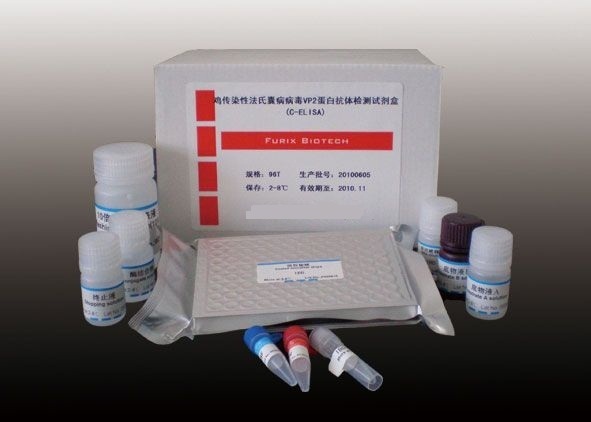 人血管活性肽酶抑制剂(VPI)ELisa检测试剂盒