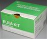 人心肌特异性肌钙蛋白T(cTnT)ELisa检测试剂盒
