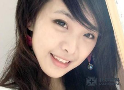 地包天矫正后会不会反弹  牙齿矫正