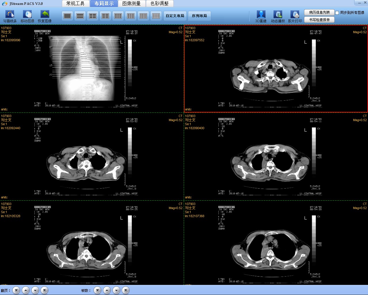 CT/MR/X光机/胃肠机影像工作站软件 模拟接  CT/MR工作站  X光机改造  胃肠机改造