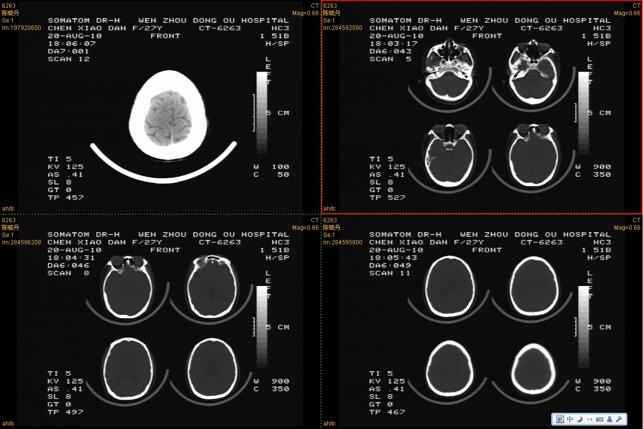CT/MR/X光机/胃肠机影像工作站软件 模拟接  CT/MR工作站  X光机改造  胃肠机改造